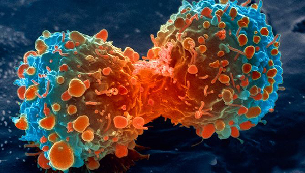 lung-cancer-cell-dividing-article.__v80030169